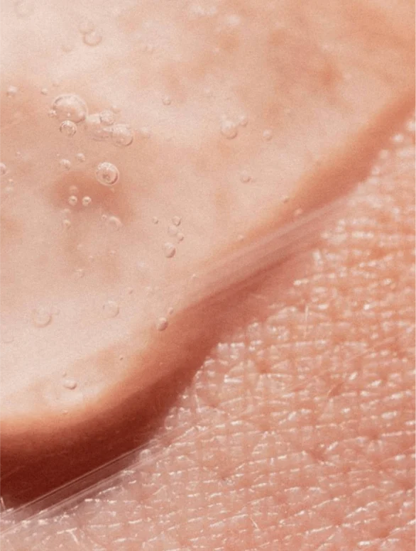 Ölfreies Zink-Gesichtsgel